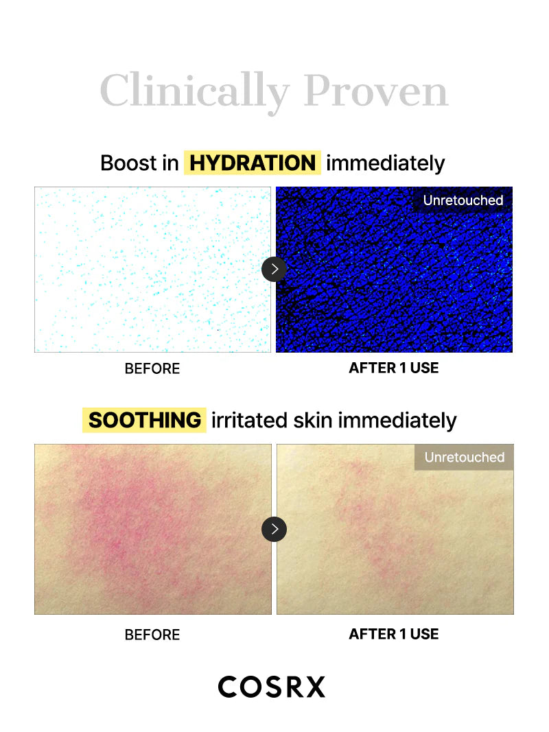 COSRX - Advanced Snail Mucin Glass Glow Hydrogel Mask - Tūfiti