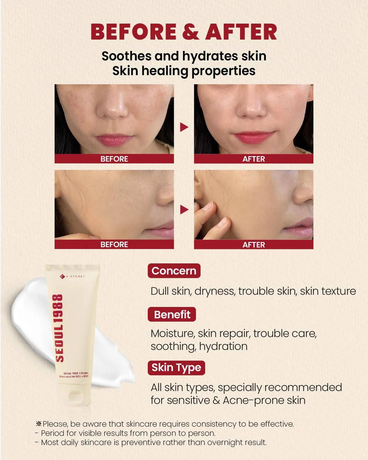 K-SECRET - SEOUL 1988 Cream : Snail Mucin 93% + Rice - 100ml - Tūfiti