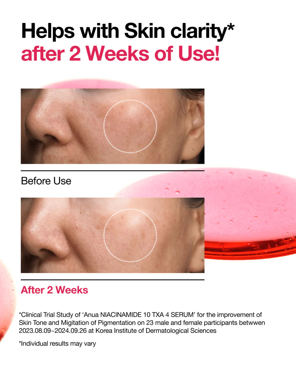 Anua - Niacinamide 10% + TXA 4% Serum - Brightening Serum with Niacinamide - 30ml - Tūfiti