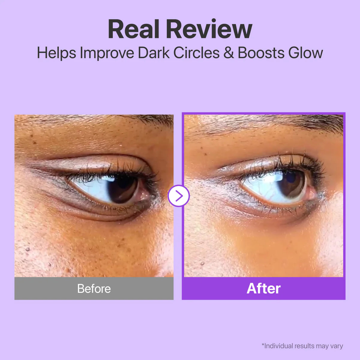 Numbuzin NAD Retinol Volumetox Eye Cream 10ml - Tūfiti